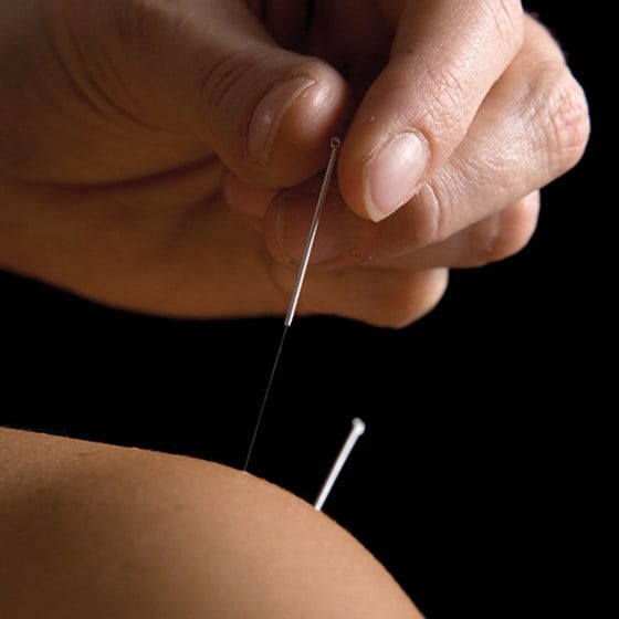Thin needle being used in acupuncture therapy on skin