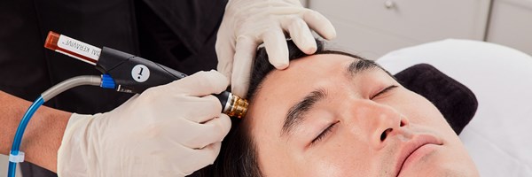 Man with dark hair receiving Keravive treatment. HydraFacial Keravive is a unique, relaxing treatment designed to cleanse, exfoliate, nourish, and hydrate the scalp for healthier and fuller-looking hair for all skin and hair types.